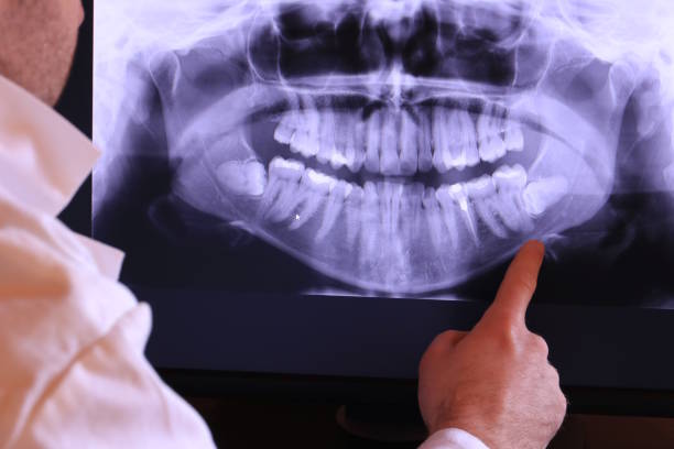Best Broken or Chipped Tooth Repair in Palm Desert, CA